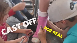 CAST COMES OFF PERMANENTLY FOR TEN YEAR OLD WHO HAD MAJOR SURGERY | NO MORE CAST FOREVER