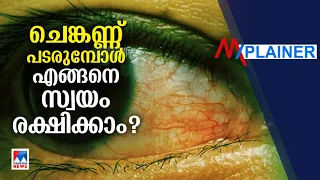 ചെങ്കണ്ണ് പടരുന്നു; എങ്ങനെ നേരിടണം; അറിയേണ്ടതെല്ലാം ​| Conjunctivitis | Mxplainer