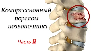 Компрессионный перелом позв-ка.  Комплекс-2.