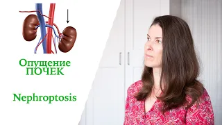 Nephroptosis. My Case.