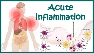 Acute Inflammation | symptoms |Pathogenesis, Cause of inflammation| Mediators of Acute Inflammation.