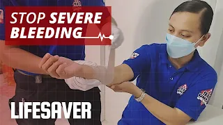 How to Stop Severe Bleeding | LIFESAVER