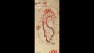 Hipertensión, sobrecarga ventricular y el BNP/NT proBNP