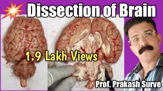 Dissection of Brain By Prof. Prakash Surve (Moderator)