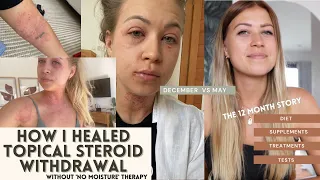 How I Healed from Topical Steroid Withdrawal - the whole story