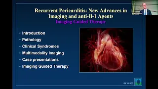 Recurrent Pericarditis: New Advances in Imaging and Anti-IL-1 Agents