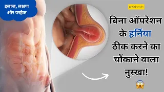 बिना ऑपरेशन के Hernia ठीक करने का चौंकाने वाला नुस्खा! Credihealth