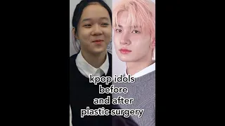 kpop idols before and after plastic surgery [ part 1 ]🔥#shorts #enhypen #itzy #ive #aespa #kpopedit