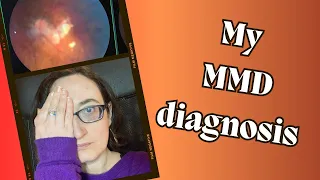 My Shocking Diagnosis: MYOPIC MACULAR DEGENERATION