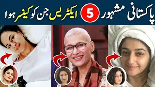 Top 5 Pakistani Actresses Who Won the Fight against Cancer