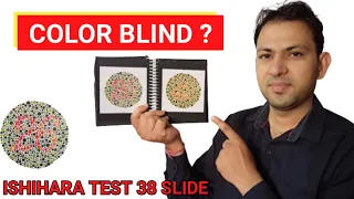 color blindness test | how to perform ishihara test procedure | ishihara test 38 plates (hindi)