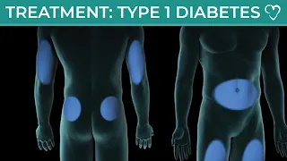 Understanding Type 1 Diabetes: Treatment