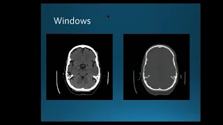 Pediatrics Brain CT Dr Ahmed Attia