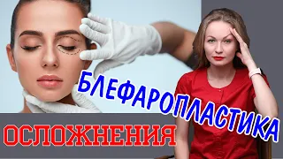 Осложнения после блефаропластики. Как их избежать? Чего надо бояться? Совет пластического хирурга.