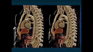 You Make the Call! Freestyle Radiology Quiz #12