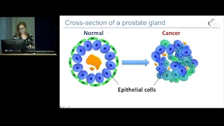 Epigenetics and cancer detection - Dr Ruth Pidsley