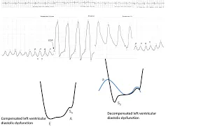 Hemodynamics 1: Essential hemodynamics, pitfalls, anomalies- Elias Hanna, Univ Iowa