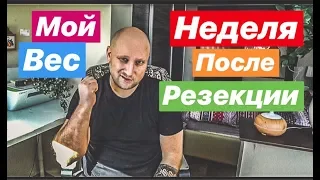 НЕДЕЛЯ ПОСЛЕ РУКАВНОЙ РЕЗЕКЦИИ ЖЕЛУДКА. МОИ ОЩУЩЕНИЯ, МОЁ ПИТАНИЕ. МОЙ ВЕС ➕➖