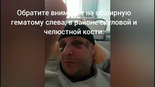 Килия Полиция избивает задержанного. Водников". Врач покрывает полицию.Поліція порушує права