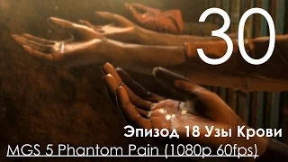 Metal Gear Solid 5 Phantom Pain Прохождение на русском Часть 30 Эпизод 18 Узы Крови