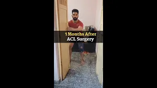 1 months After ACL Surgery with fibertape internal brace