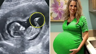 Pregnant Girl Visits The Doctor. After Seeing The Ultrasound, He Immediately Calls The Cops!