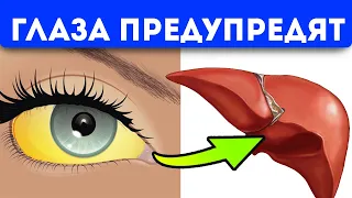 Внимание! 11 сигналов, при помощи которых глаза предупреждают о проблемах со здоровьем
