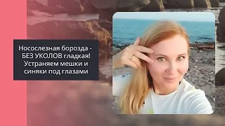 Носослезная борозда БЕЗ УКОЛОВ гладкая! Устраняем мешки и синяки под глазами