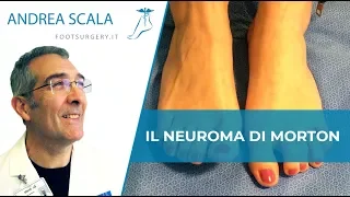 NEUROMA DI MORTON Quali sono le cause, i sintomi e i rimedi? | NEUROMA DI MORTON TERAPIA