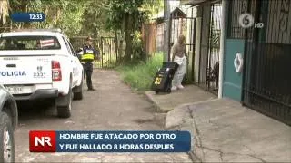 Hombre estuvo 8 horas con una herida de bala en su cabeza