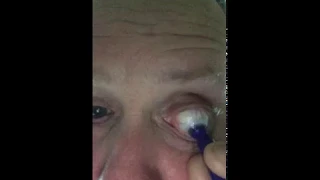 Taking out a contact lens