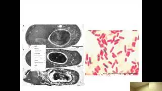 Chapter 3 (Part 4) Internal structures prokaryotes
