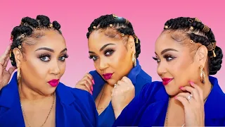 How to Cover Bald Edges: Stylish Cornrows | Traction Alopecia