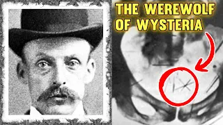 Albert Fish: The Werewolf of Wysteria