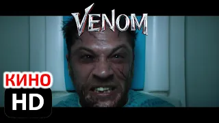 Эдди обследуют в больнице // Фрагмент из Веном // Venom (2018)