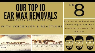 TOP 10 EAR WAX REMOVAL VIDEOS - NUMBER 8