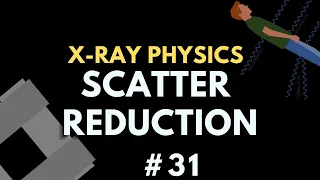 Scatter Reduction | X-ray Physics | Radiology Physics Course #38