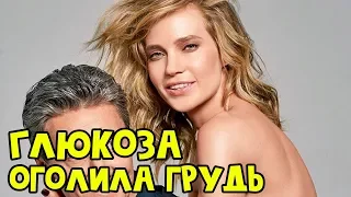 "Плохая девочка": Глюкоза оголила грудь