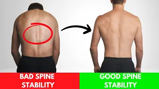 How To Improve Your Spine Stability By Strengthening Your Erector Spinae