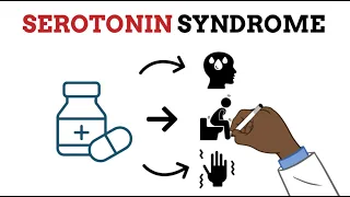 Serotonin Syndrome  MADE EASY  - Your professor made it too complicated