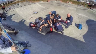 DAD BREAKS HIS LEG IN TWO PLACES AT SKATE PARK WITH FOUR KIDS