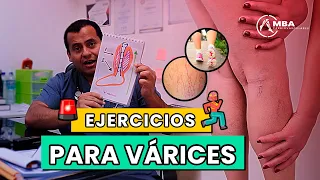 LOS 8 EJERCICIOS PARA VÁRICES /  ¿CÓMO SE HACEN? Paso a Paso explicado