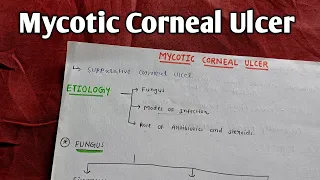 MYCOTIC CORNEAL ULCER | A K KHURANA | OPHTHAL