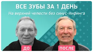 Все зубы за 1 день: отзыв пациента через 8 месяцев