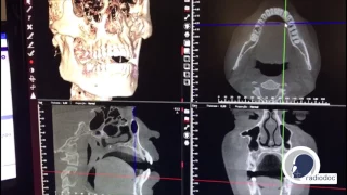 Como é feito um estudo em Tomografia?