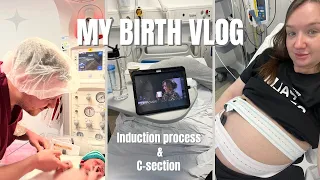 MY BIRTH VLOG & STORY | Induction & C-section