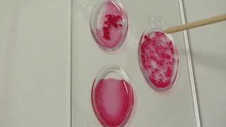 Blood Typing Lab Demo