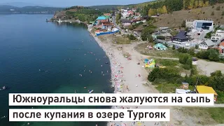 Южноуральцы снова жалуются на сыпь после купания в озере Тургояк