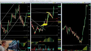 Opce na akcii JNJ +250% a setup na XLY s denním Squeezem | Dominik Kovařík