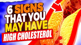 High Cholesterol Alert: 6 Symptoms You Shouldn't Ignore